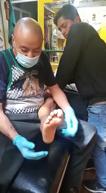 Man goes to a traditional doctor instead of the hospital to treat his broken leg after a motorcycle accident.